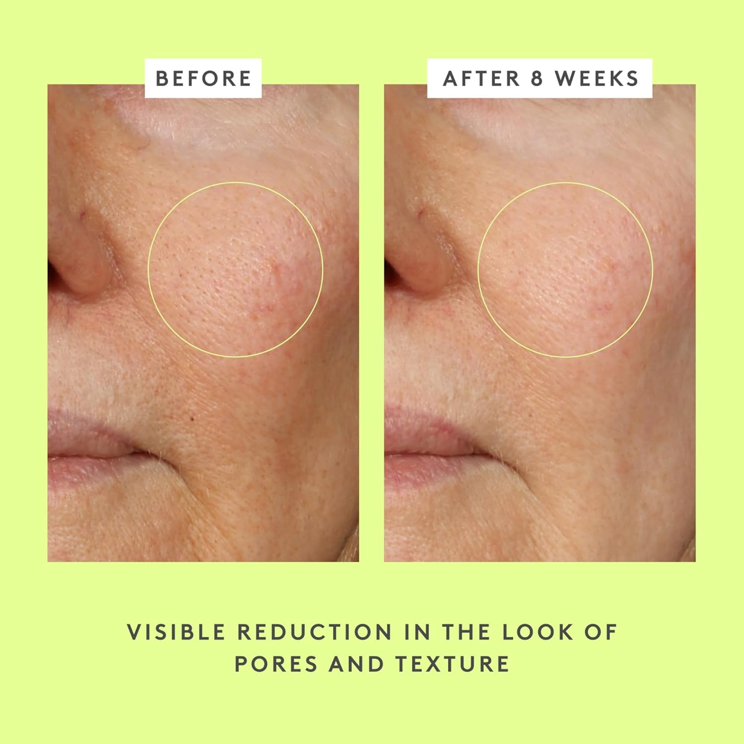 Drunk Elephant T.L.C. Framboos Glycolic Serum – Exfoliating AHA/BHA Serum for Smoother Skin Texture & Clear Pores – Clean, Cruelty-Free, Fragrance-Free, Dermatologist-30Ml