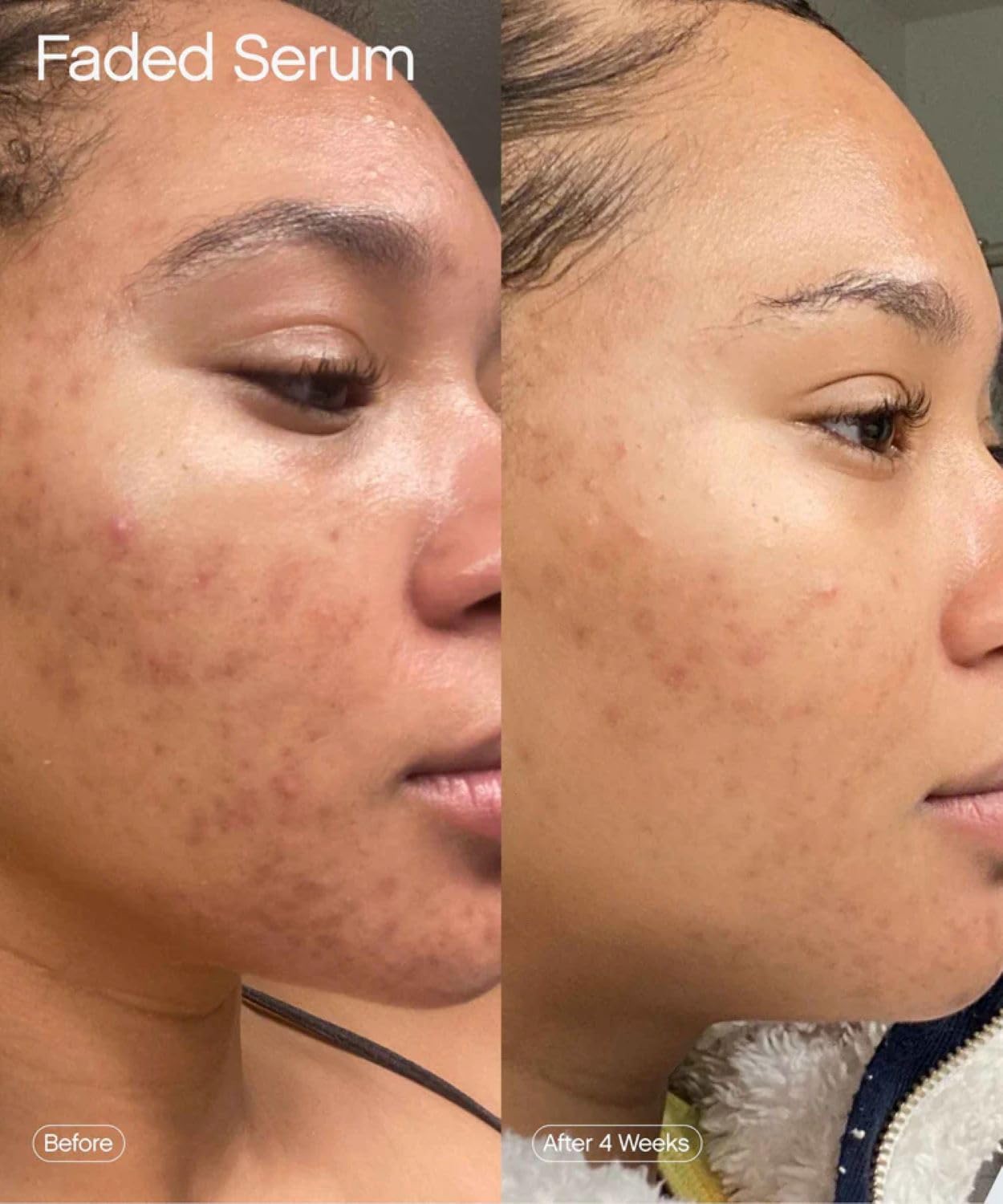 Topicals Faded Brightening & Clearing Serum – Reduces Discoloration, Scars & Spo