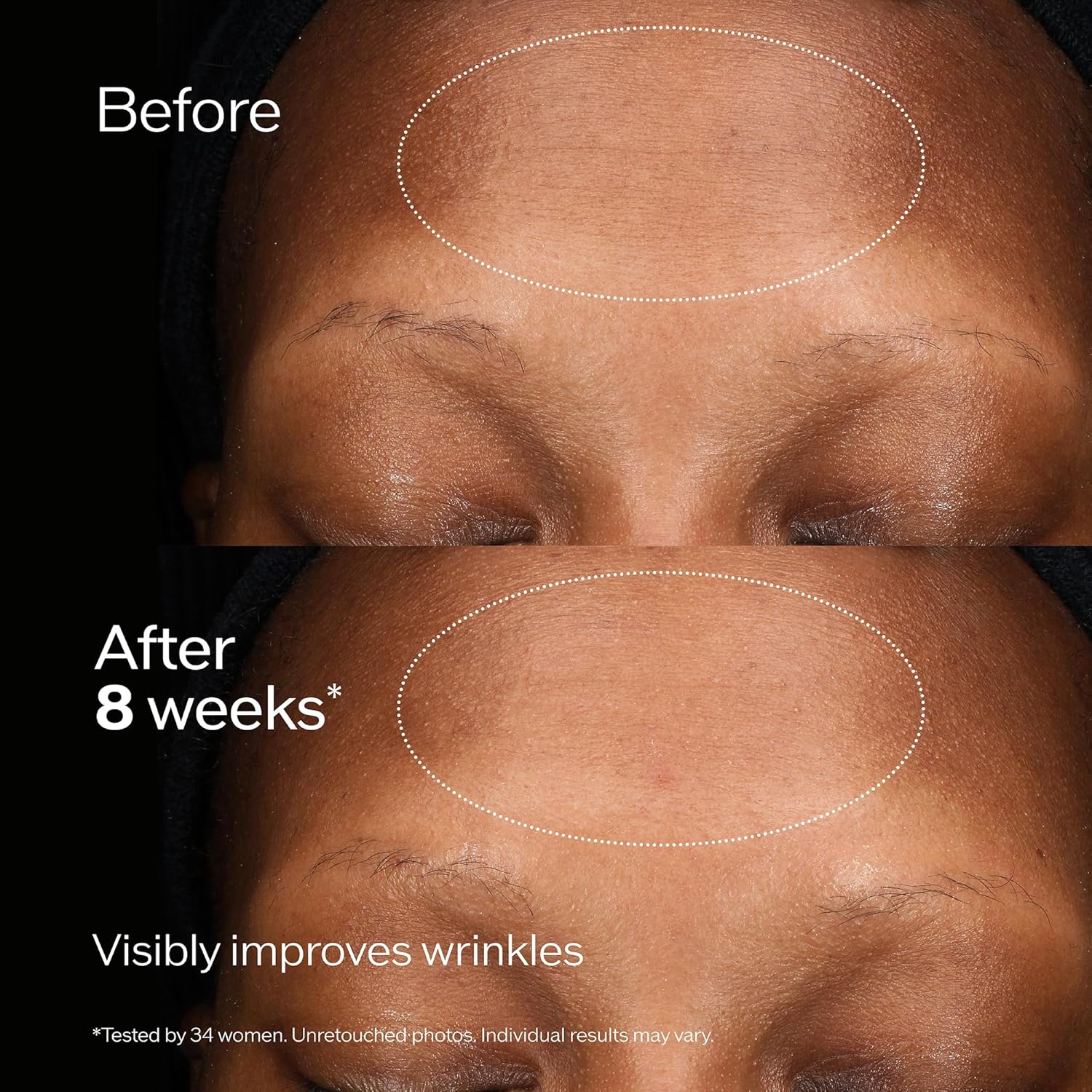 Shiseido Future Solution LX Total Regenerating Cream – Anti-Aging Night Moisturi