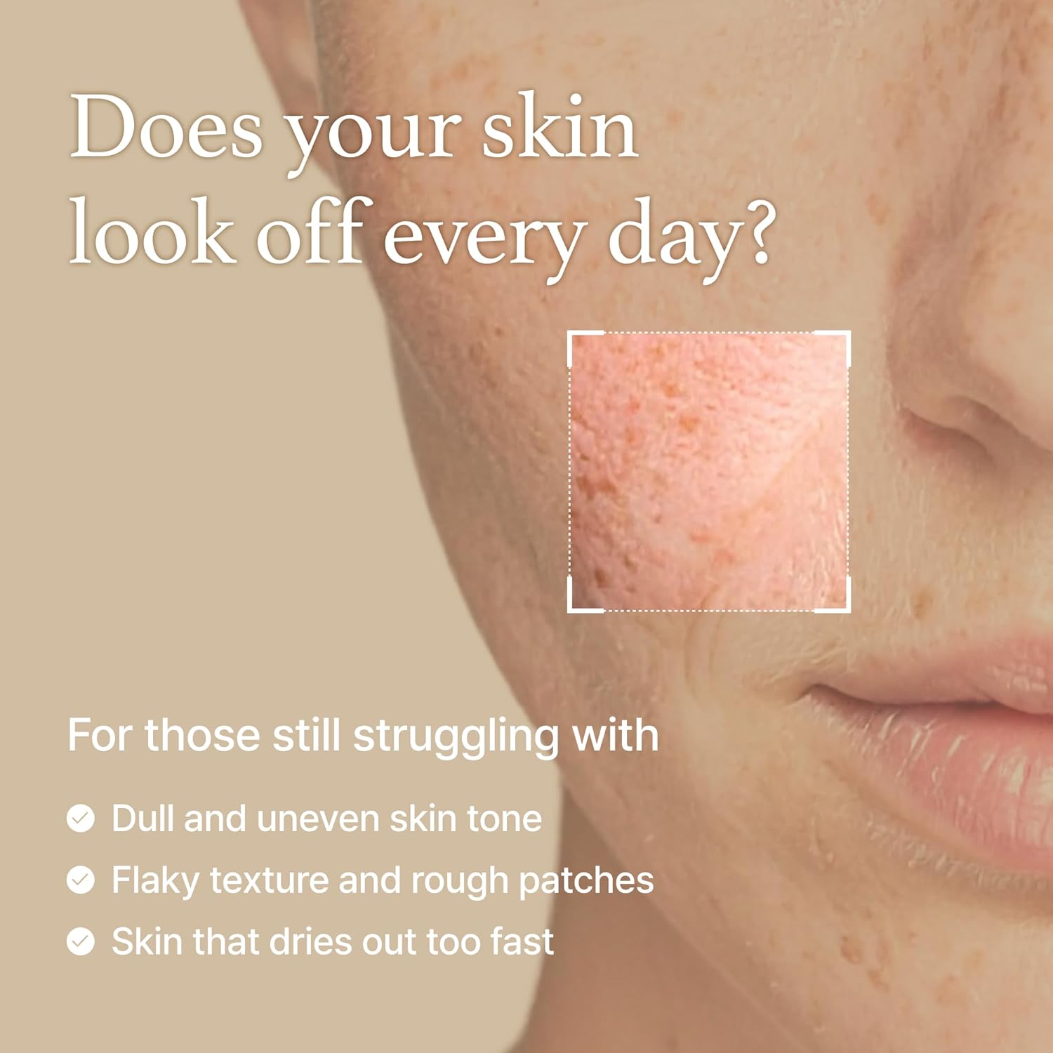 I’m From Rice Toner – Milky Glow Toner with Korean Rice & Niacinamide for Hydrat