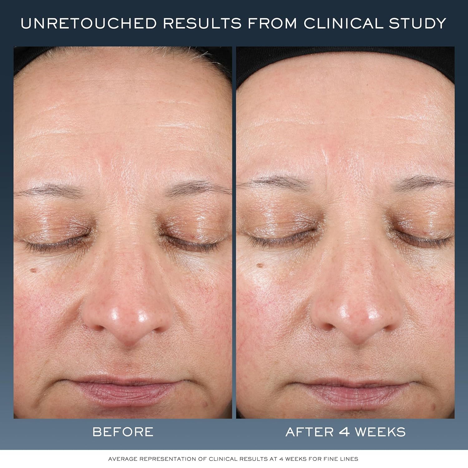 Lancôme Advanced Génifique Night Cream – Overnight Skin Repair with Bifidus Preb