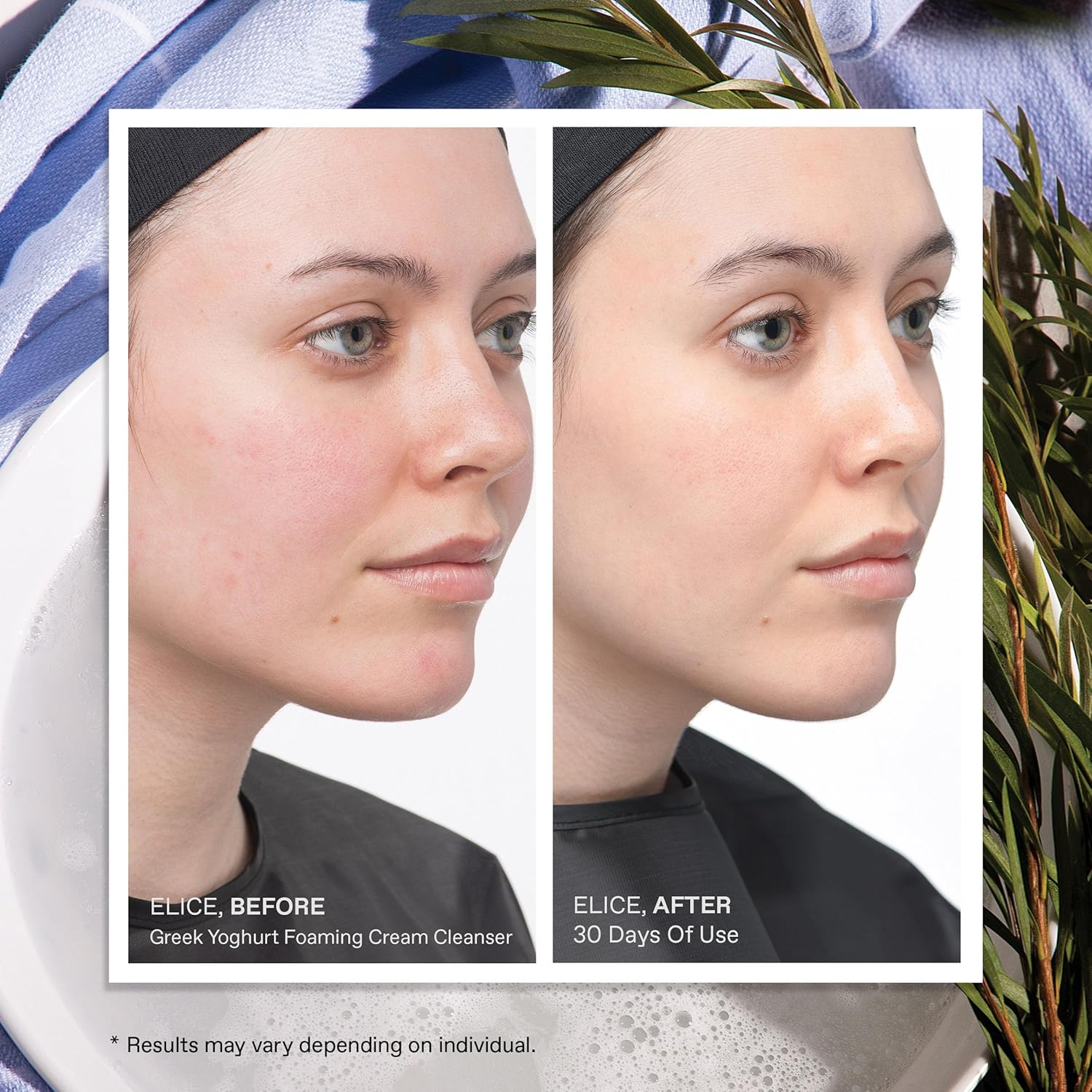 KORRES Greek Yoghurt Foaming Cream Cleanser – Hydrating Deep Cleanse & Makeup Re