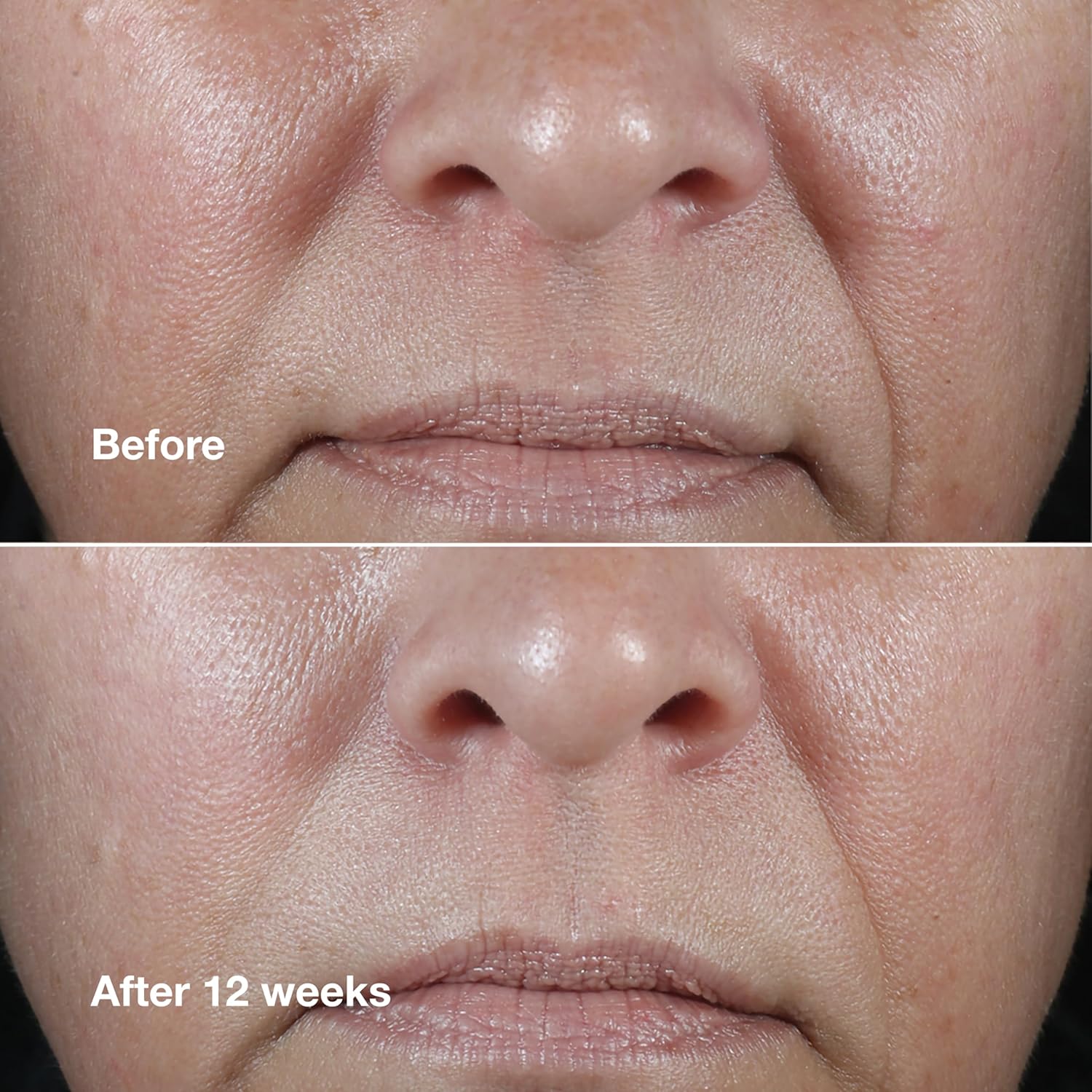 Clinique Smart Clinical Repair Wrinkle Correcting Anti-Aging Rich Face Cream – P