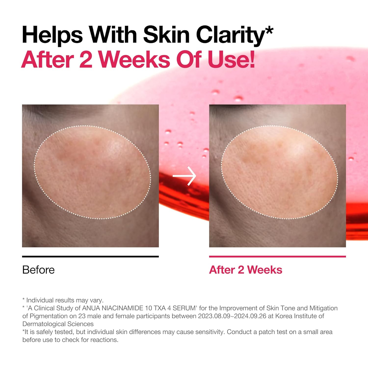 ANUA Niacinamide 10% + TXA 4% Serum – Korean Skincare for Glass Skin, Dark Spot 