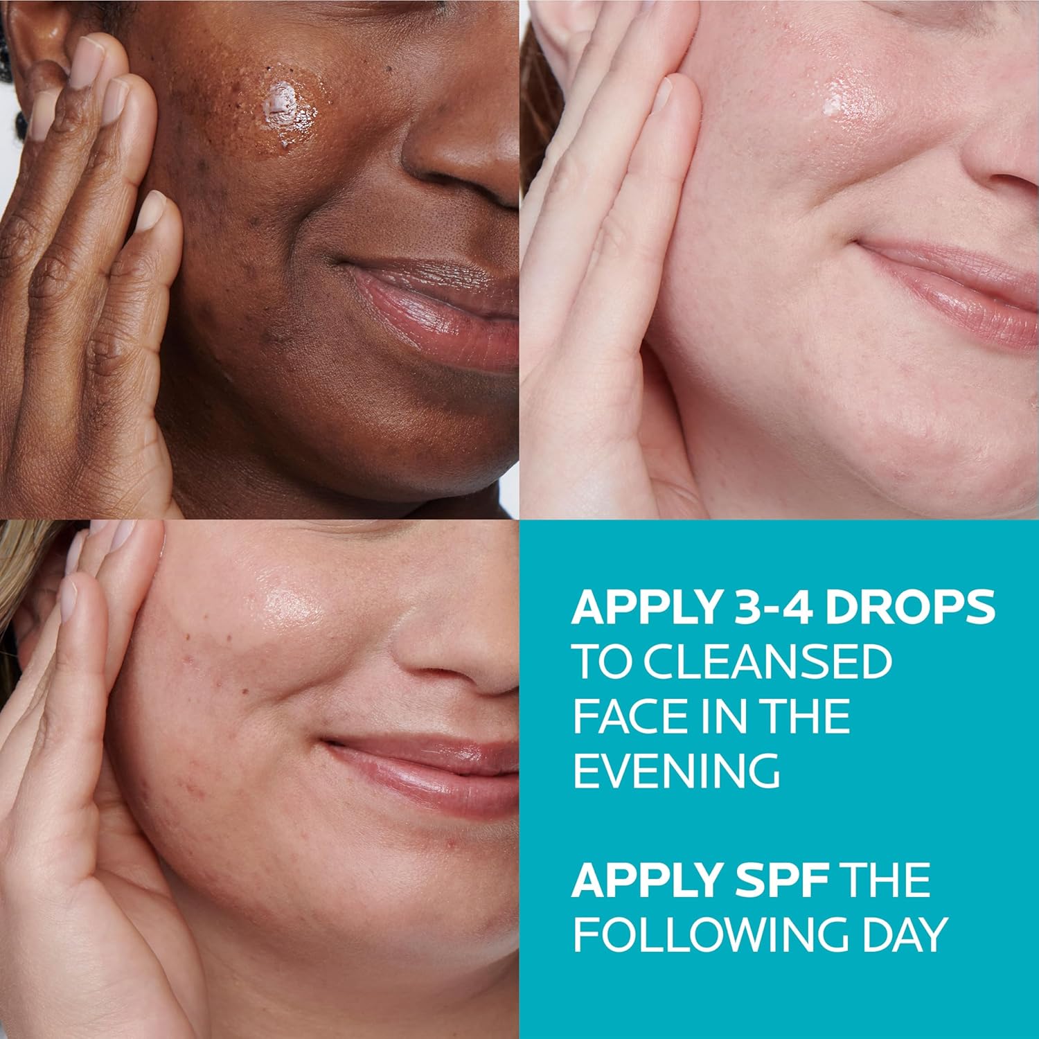 La Roche-Posay Effaclar 1.5% Salicylic Acid Face Serum – Acne Treatment with Gly