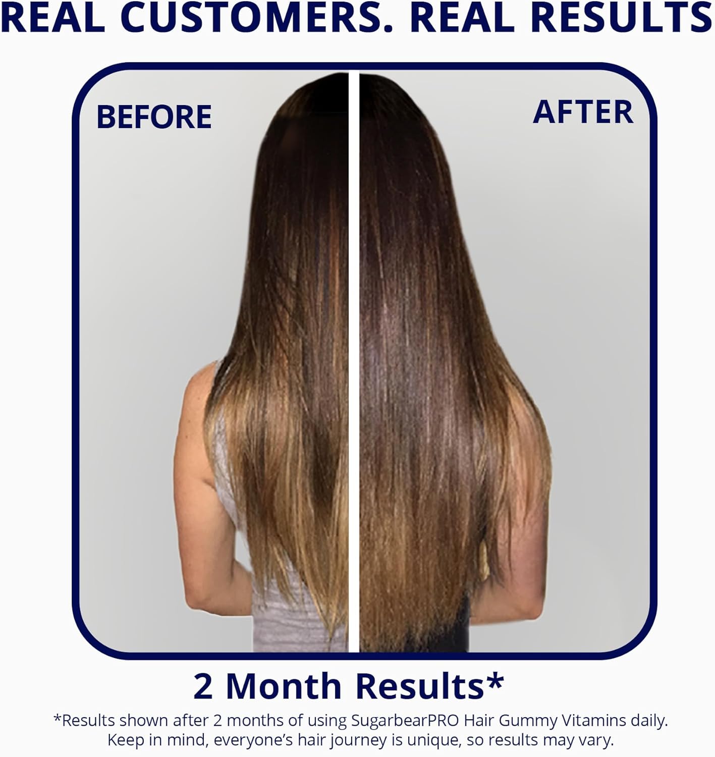 SugarBearPro Hair Vitamin Gummies – 35-Day Supply, Extra Strength Biotin 6000mcg