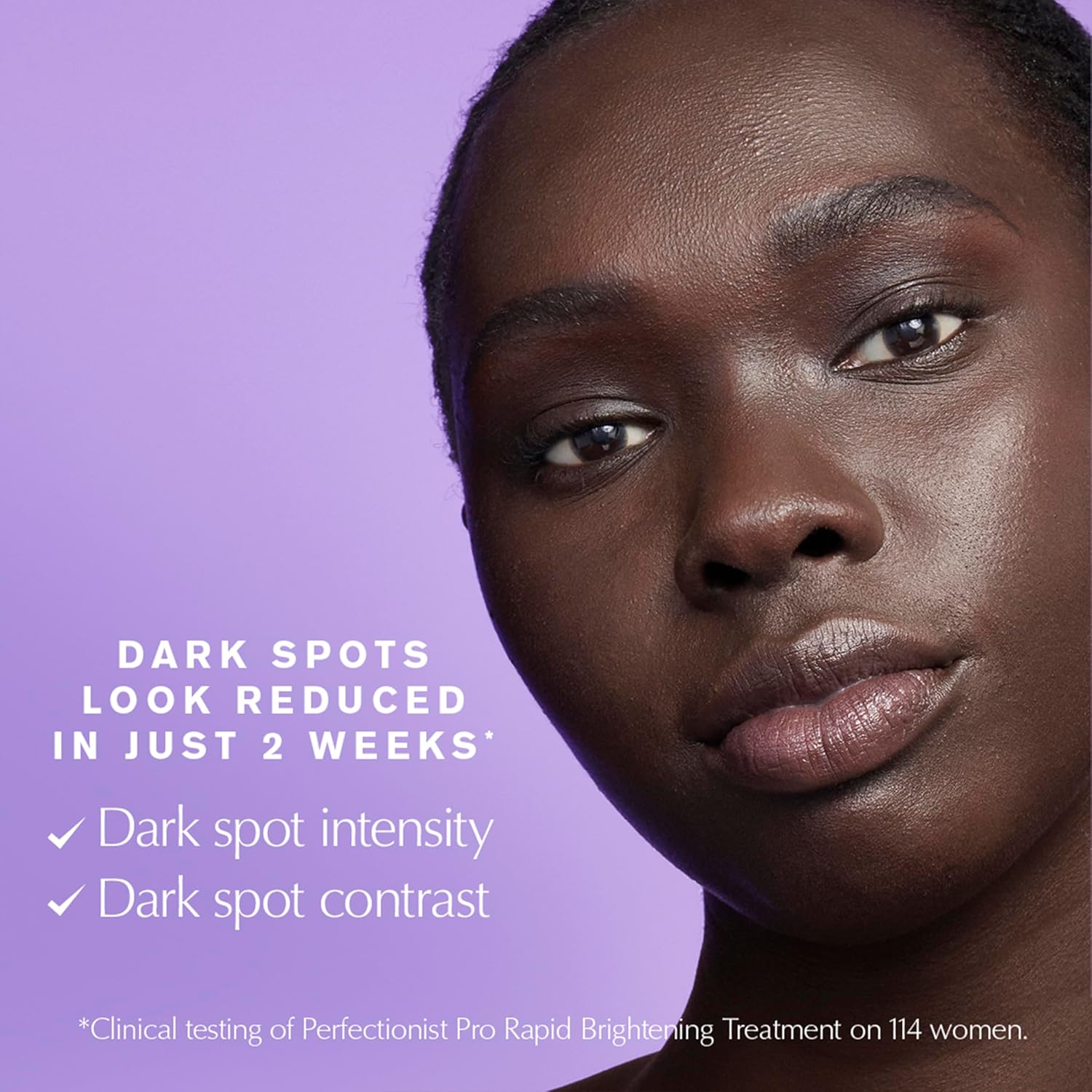 Estée Lauder Perfectionist Pro Rapid Brightening Serum with Vitamin C & Ferment3 – Dark Spot Corrector, 1.7 fl oz