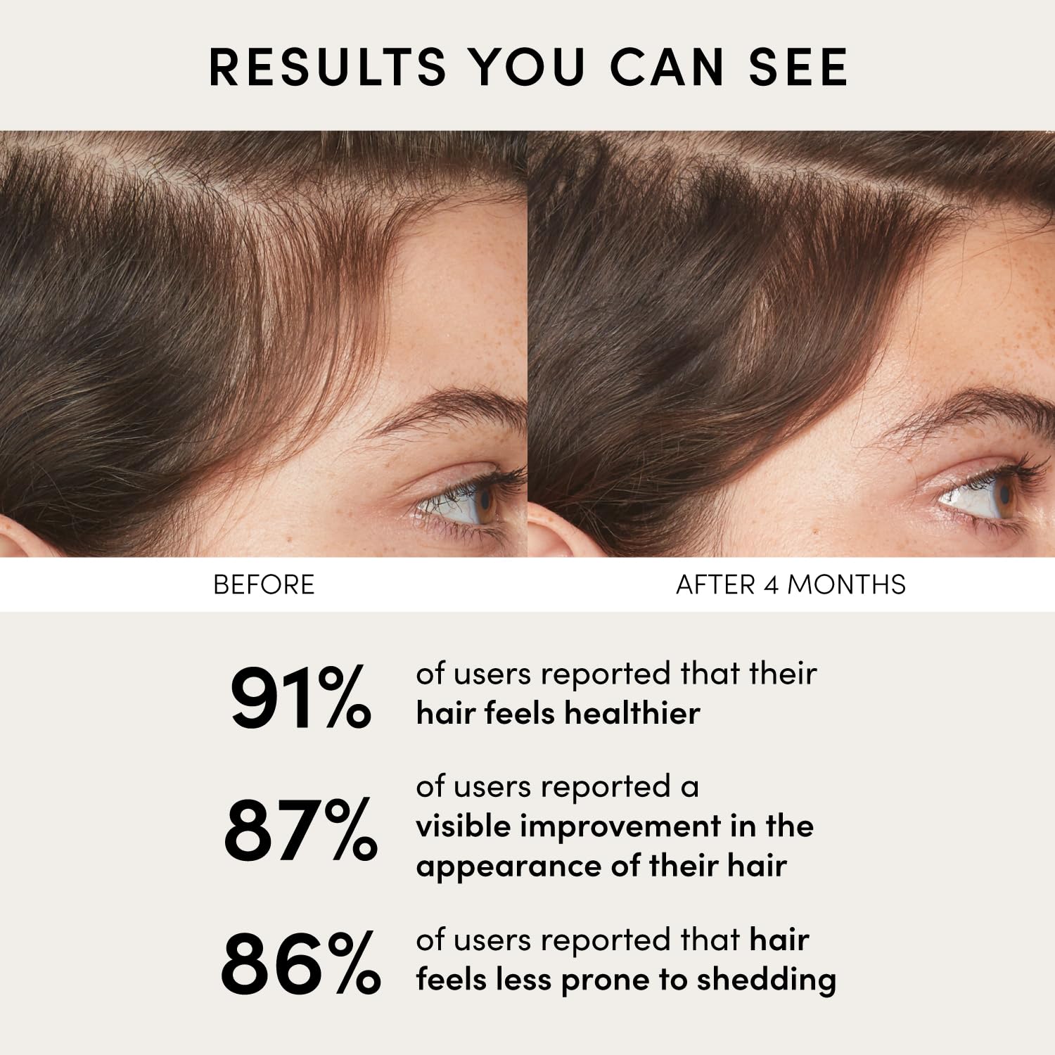 OUAI Scalp Serum – Balancing Hair & Scalp Treatment with Peptides, Red Clover & Siberian Ginseng for Thicker Fuller-Looking Hair (2 fl oz)