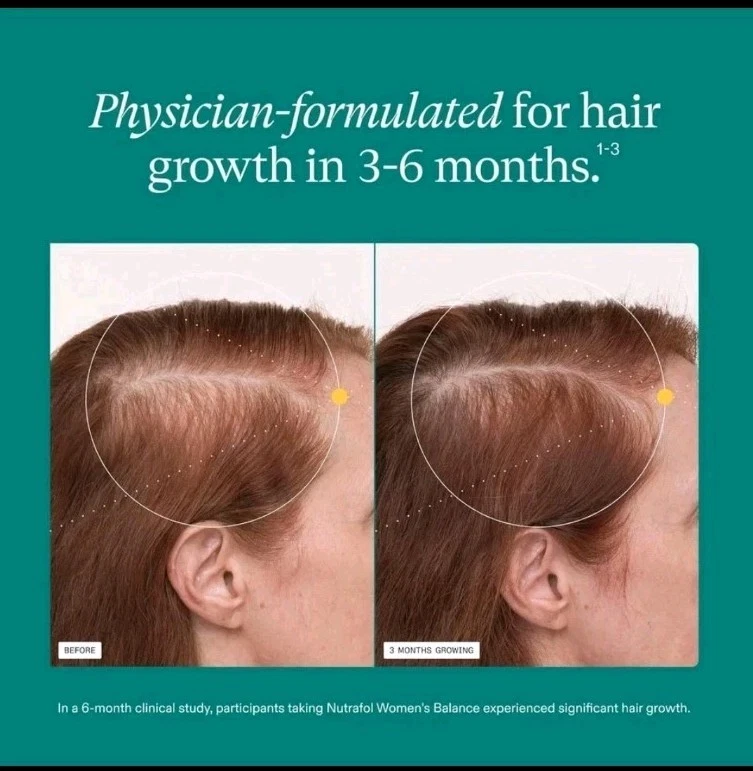Nutrafol Women’s Balance Hair Growth Supplement – Thicker Hair & Scalp Coverage