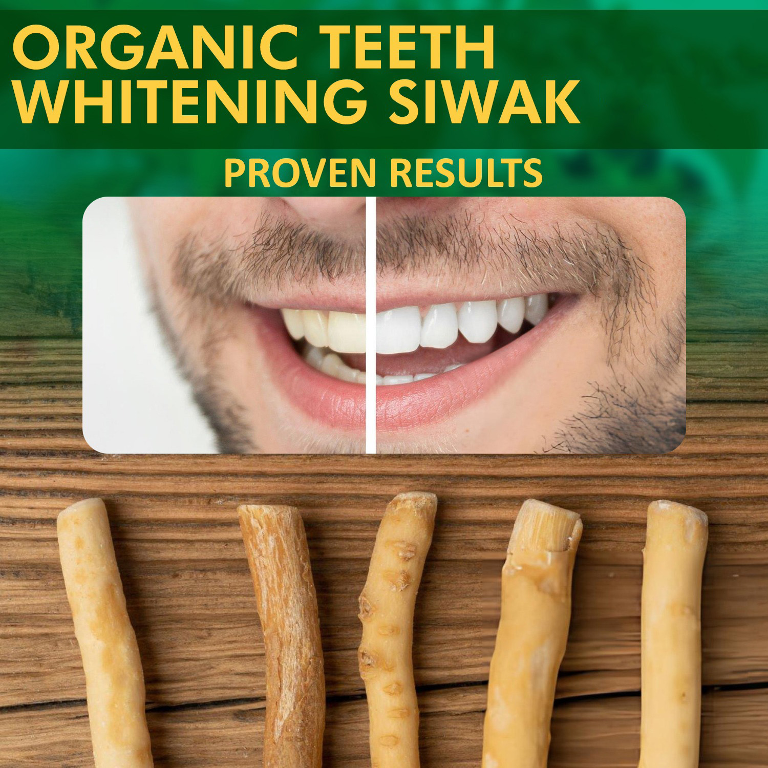 Miswak Sticks for Teeth (Pack of 10 with 2 Holders) Herbal Oral Care, No Toothpaste Needed – 100% Organic Chewing Sticks, Salvadora Persica (6 inch)