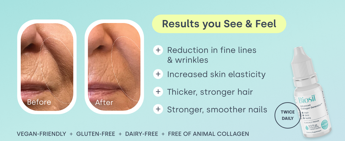 Biosil Collagen Booster Supplement – 120 Capsules, Patented ch-OSA for Skin, Hai banner 2