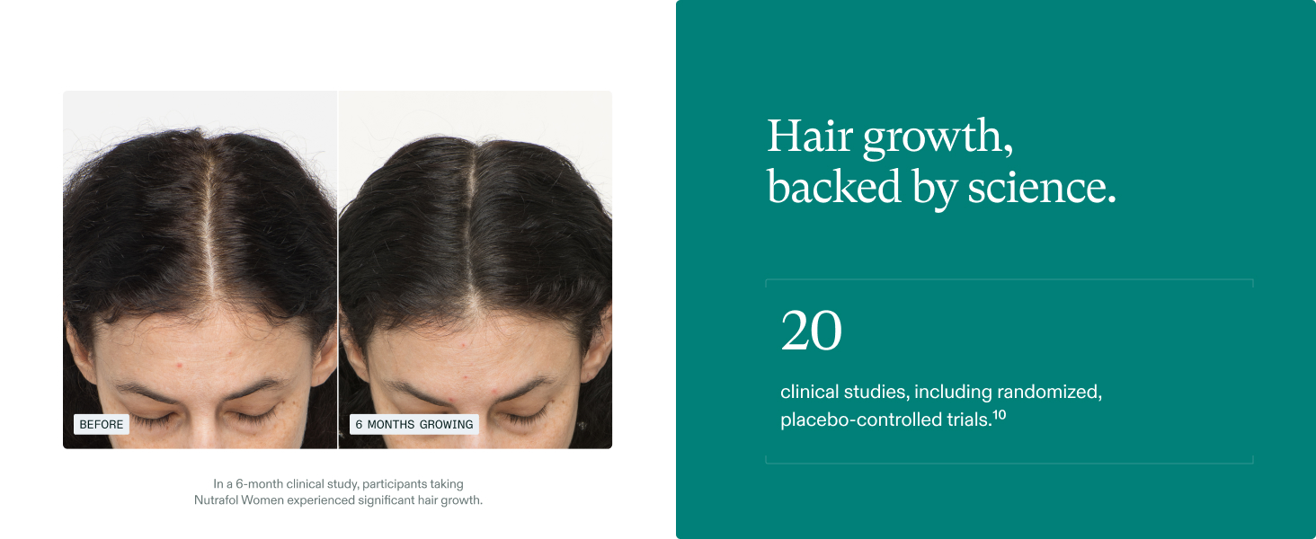 Nutrafol Women’s Hair Growth Supplements (Ages 18-44) – Clinically Proven for Th banner 2