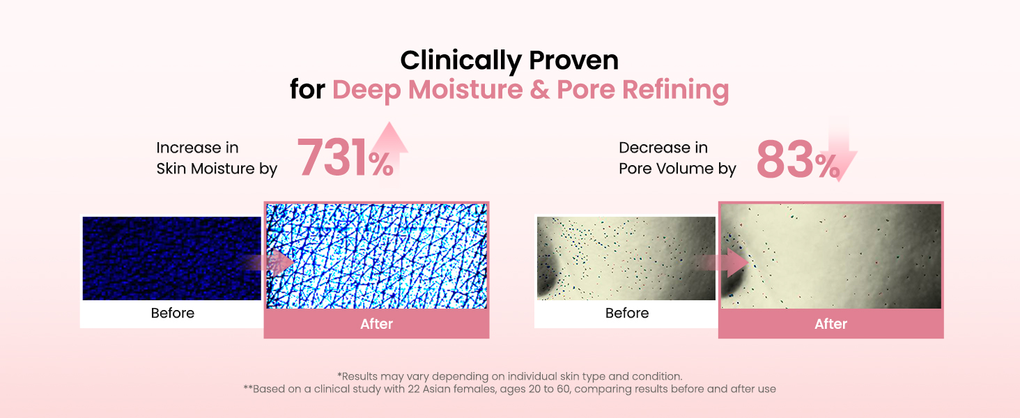 Hydrating Overnight Hydrogel Collagen Face Mask, Pore Minimizing & Elasticity Boosting, Deep Moisturizing & Plumping Skincare Treatment, Travel-Friendly Self Ca banner 4