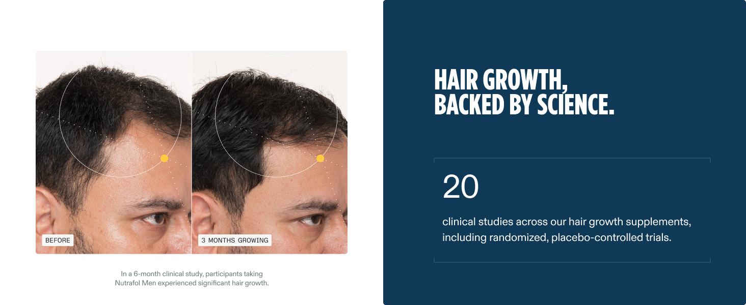 Nutrafol Men’s Hair Growth Supplements – Thicker Hair & Scalp Support 1 Month Supply 120 Capsules banner 2