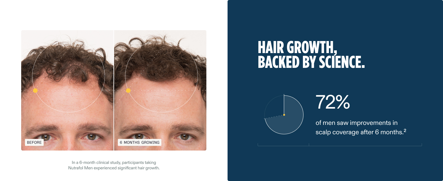 Nutrafol Men’s Hair Growth Supplements – Thicker Hair & Scalp Support 1 Month Supply 120 Capsules banner 4
